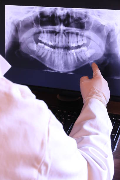 Best Emergency Wisdom Teeth Removal in Tuttle, OK