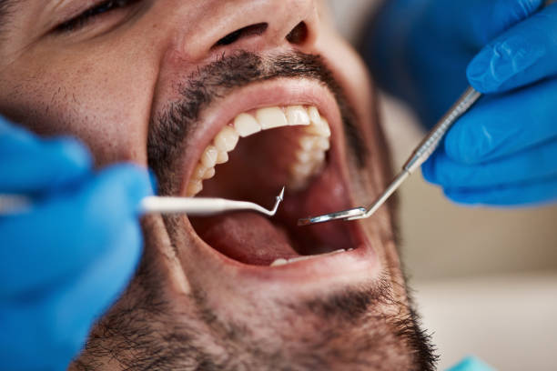 Best After-Hours Emergency Dentist in Tuttle, OK